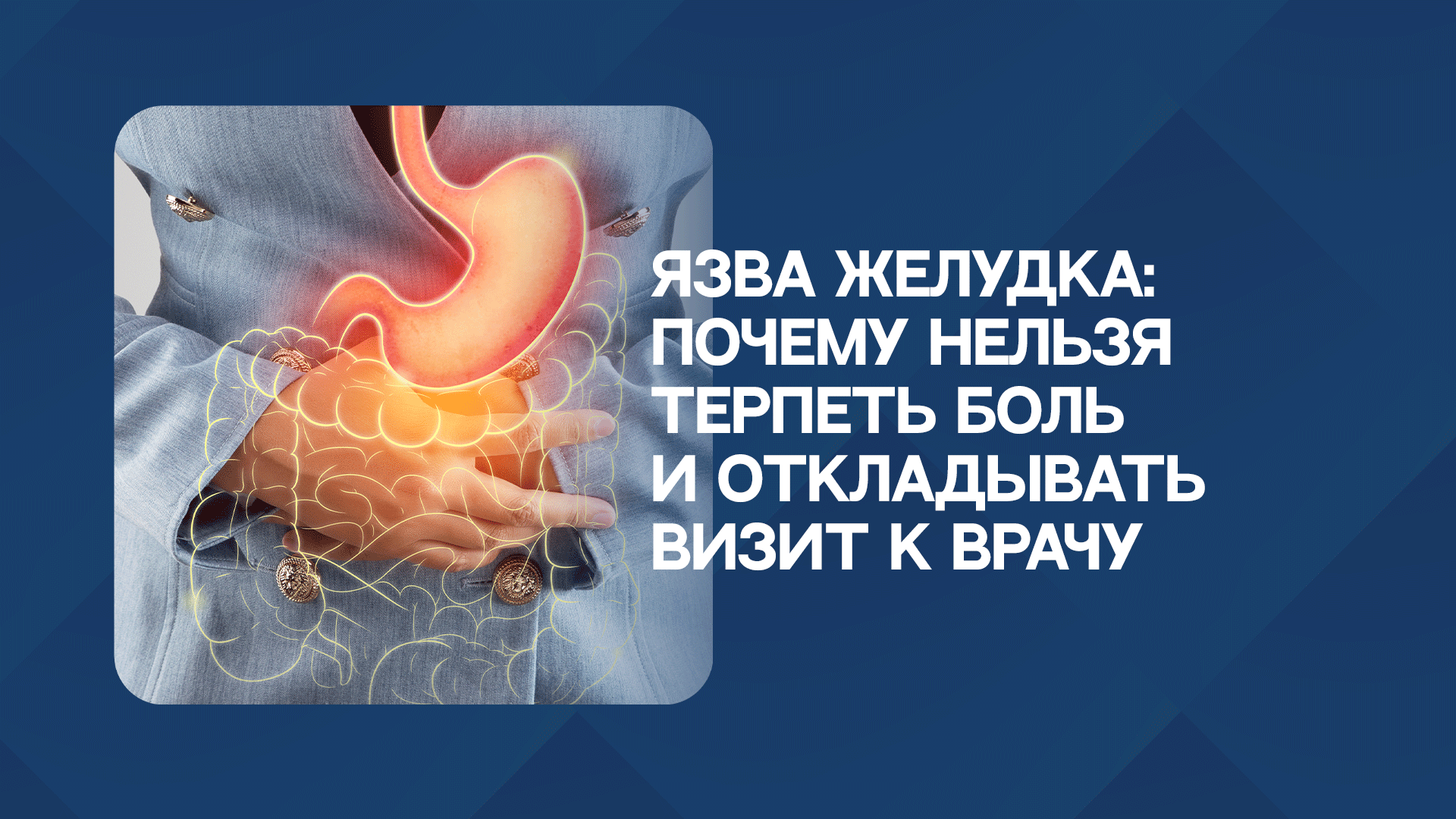 Язва желудка: почему нельзя терпеть боль и откладывать визит к врачу?