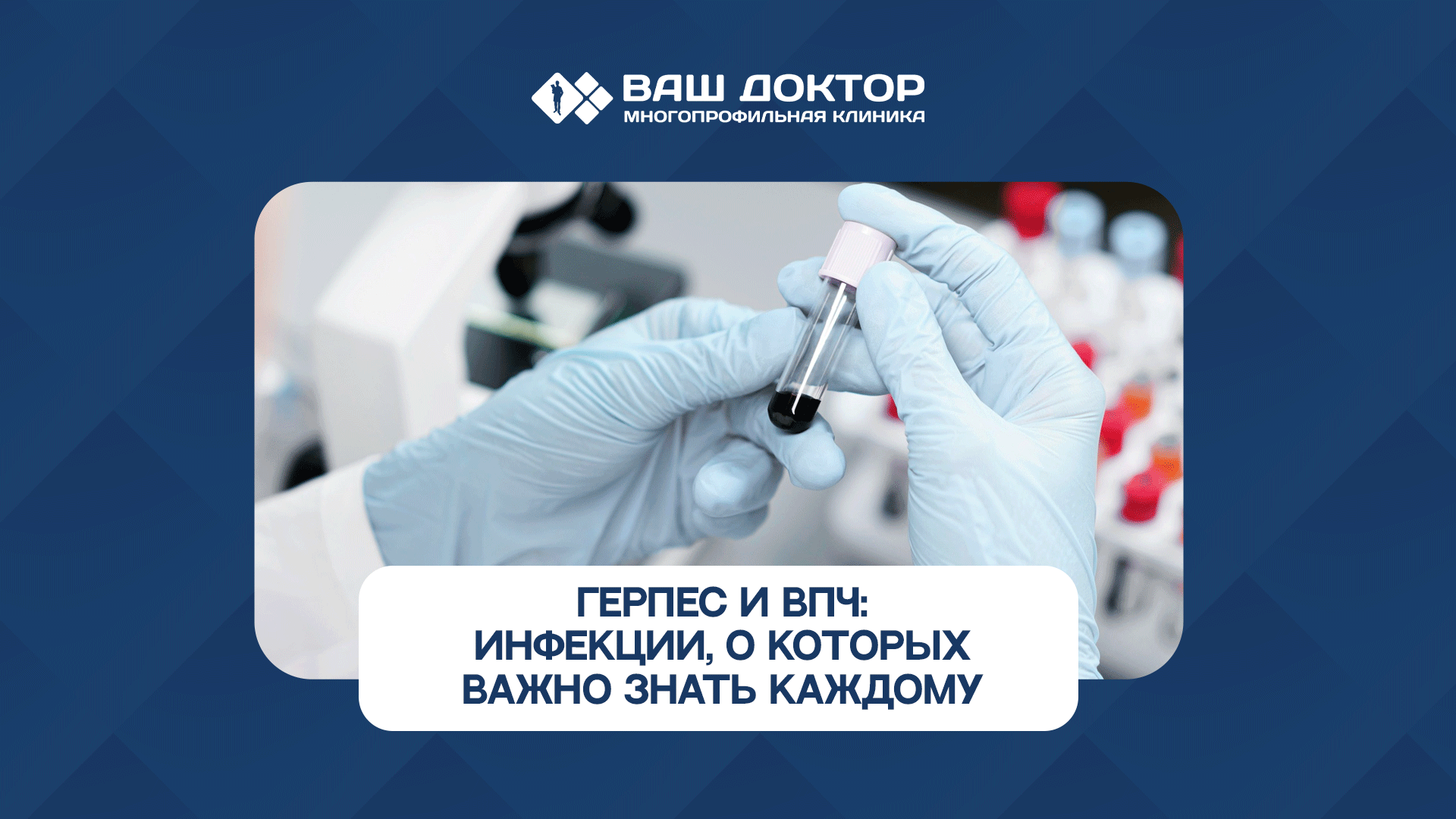 Знаете ли вы, что вирусом простого герпеса заражены до 90% людей?