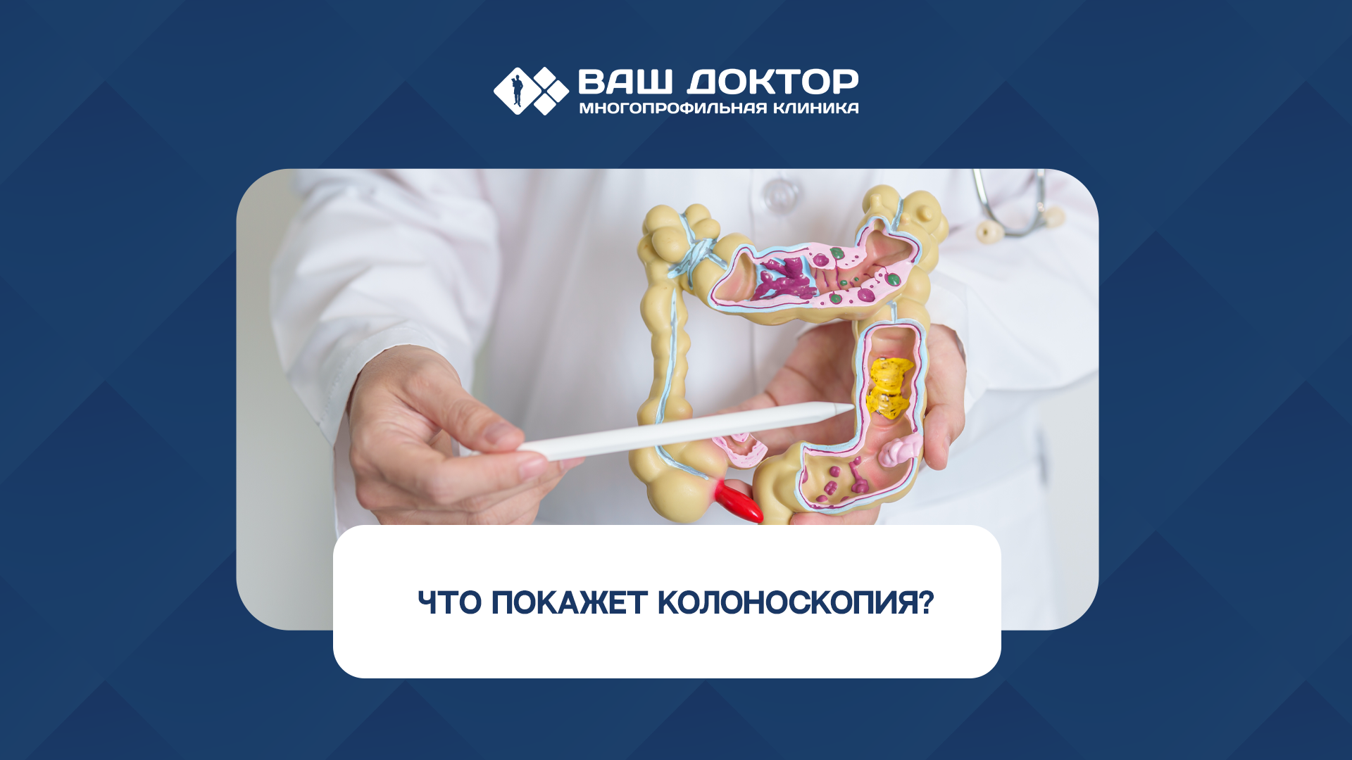 Что покажет колоноскопия?