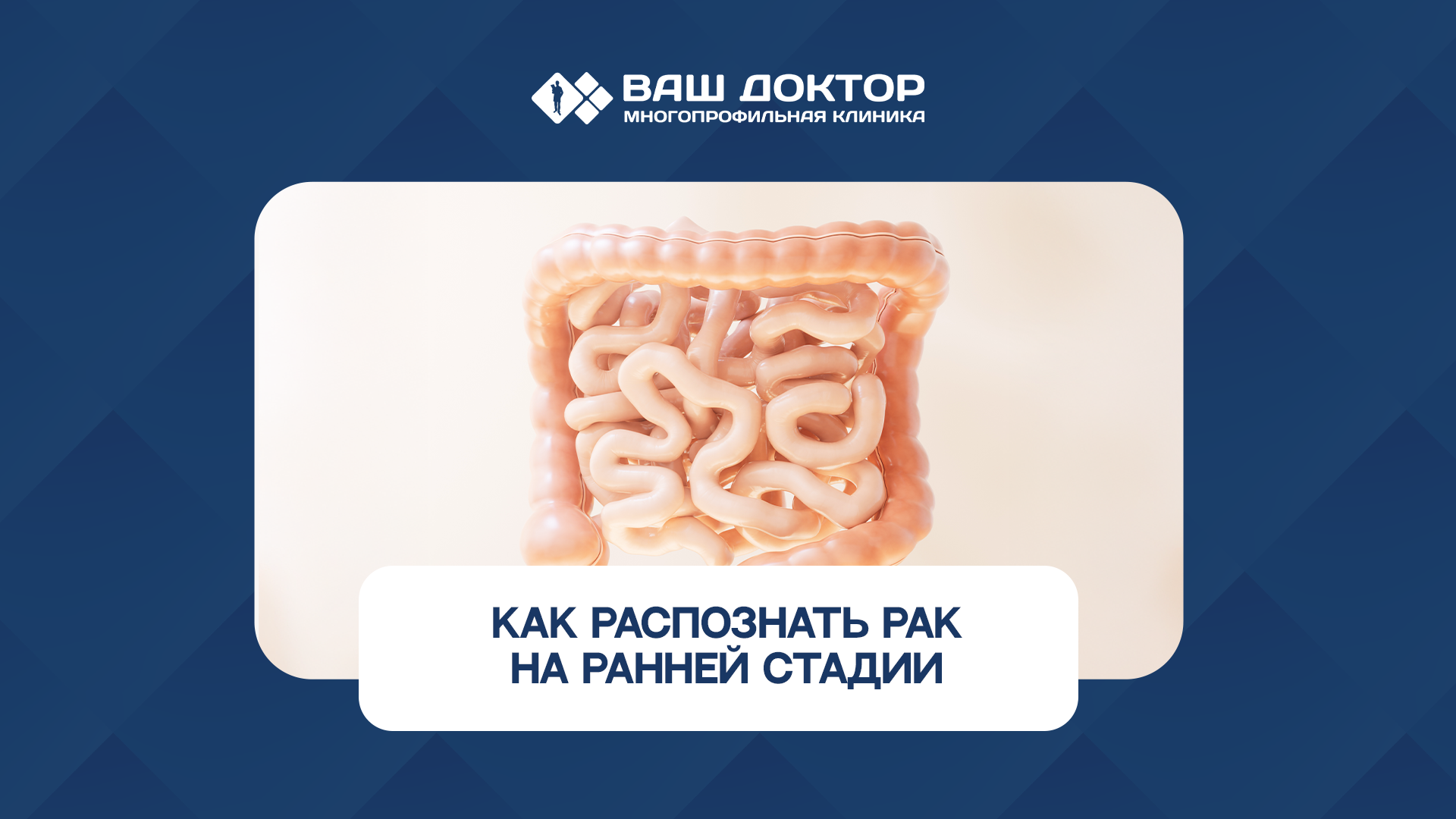 Как распознать рак кишечника на ранней стадии?