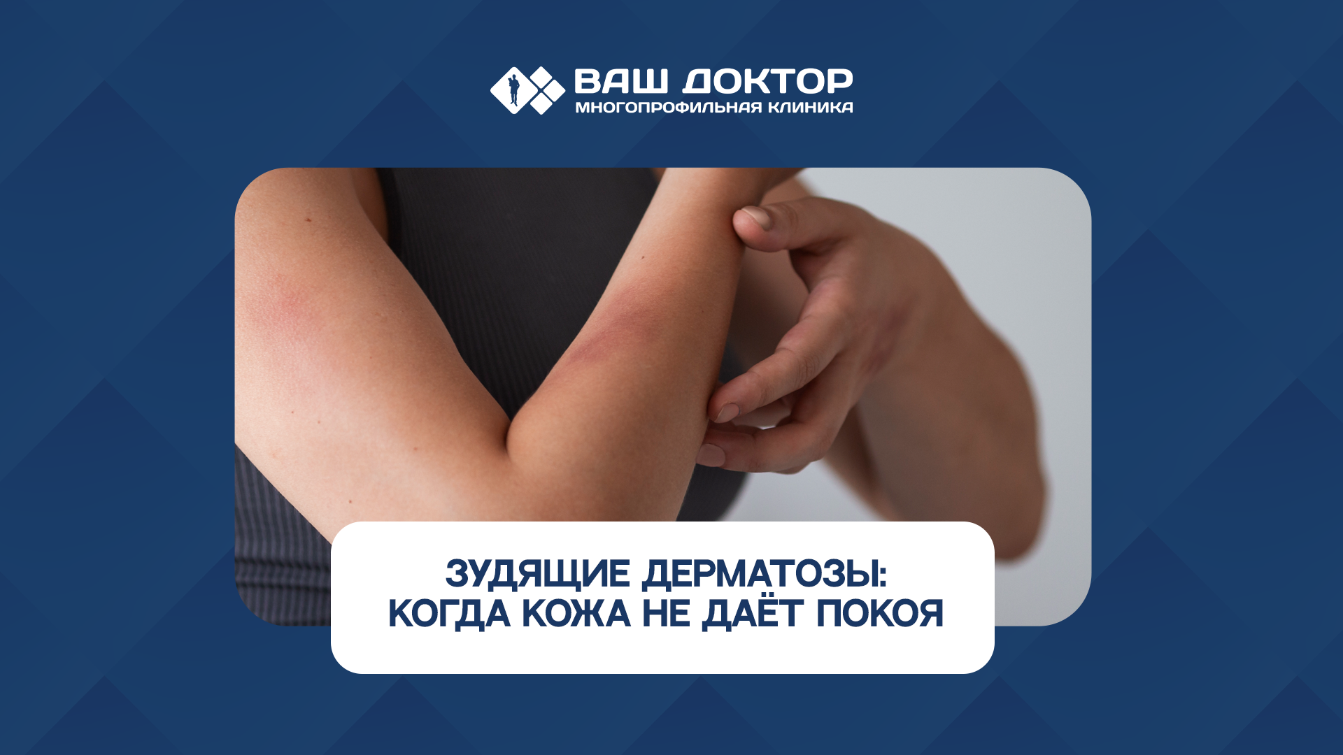 Когда кожа не даёт покоя: разбираемся с причинами зуда